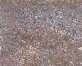 LotsOfRocks21_seamless